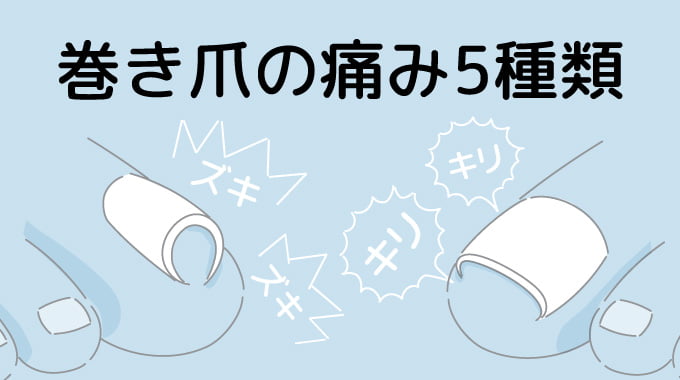 巻き爪の痛みの種類