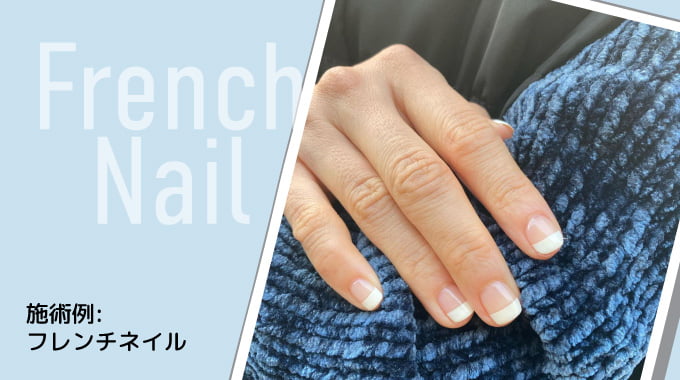 施術例：フレンチネイル