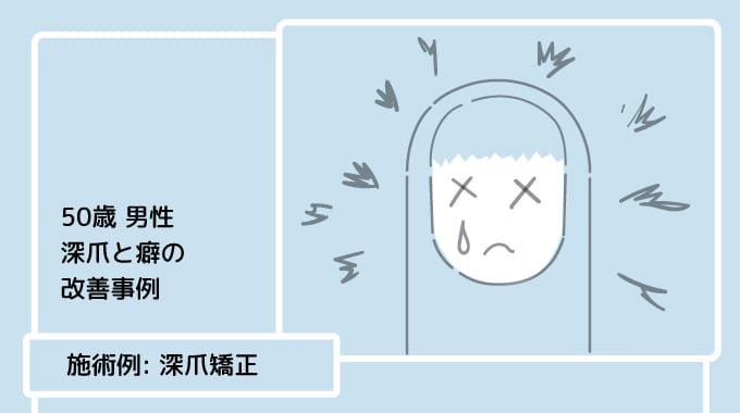 深爪と癖の改善事例